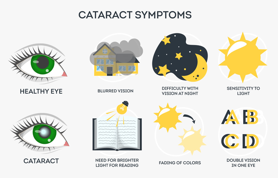 Cataract Symptoms